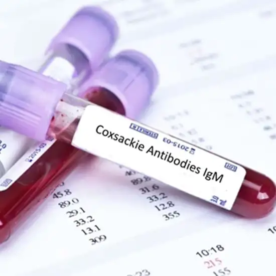 coxsackie antibody, igm